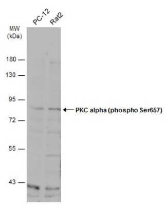 <b>Biological Strategies Validation. </b>Western Blot: PKC alpha [p Ser657] Antibody [NBP3-13311] - Various whole cell extracts (30 ug) were separated by 7.5% SDS-PAGE, and the membrane was blotted with PKC alpha (phospho Ser657) antibody (NBP3-13311) diluted at 1:500. The HRP-conjugated anti-rabbit IgG antibody (NBP2-19301) was used to detect the primary antibody.